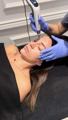 Dermapen