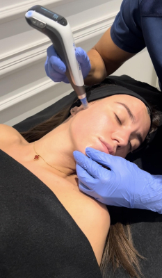 Dermapen 2
